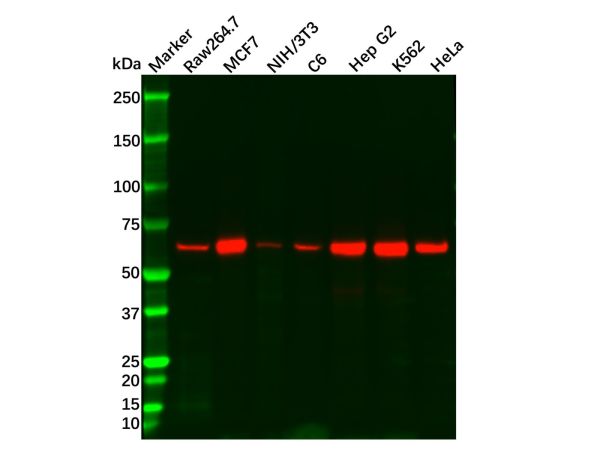 aladdin 阿拉丁 Ab088655 Recombinant AMPK alpha 1 Antibody Recombinant (R02-3H6); Rabbit anti Human AMPK alpha 1 Antibody; WB, IHC, ICC, IF; Unconjugated