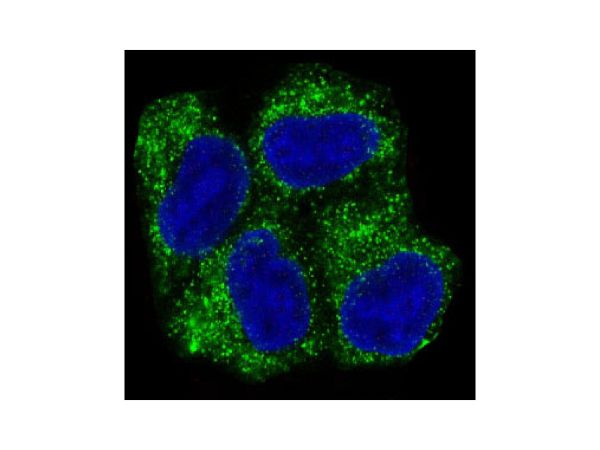 aladdin 阿拉丁 Ab088655 Recombinant AMPK alpha 1 Antibody Recombinant (R02-3H6); Rabbit anti Human AMPK alpha 1 Antibody; WB, IHC, ICC, IF; Unconjugated