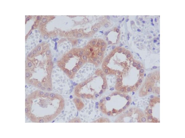 aladdin 阿拉丁 Ab088655 Recombinant AMPK alpha 1 Antibody Recombinant (R02-3H6); Rabbit anti Human AMPK alpha 1 Antibody; WB, IHC, ICC, IF; Unconjugated