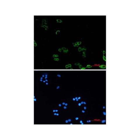 aladdin 阿拉丁 Ab088680 Recombinant AMPK gamma 1 Antibody Recombinant (R05-2F6); Rabbit anti Human AMPK gamma 1 Antibody; WB, ICC, IF; Unconjugated