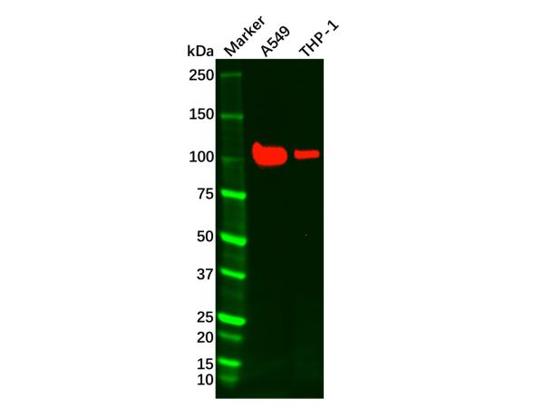 aladdin 阿拉丁 Ab088758 Recombinant Androgen Receptor Antibody Recombinant (RR632); Rabbit anti Human Androgen Receptor Antibody; WB, IHC; Unconjugated