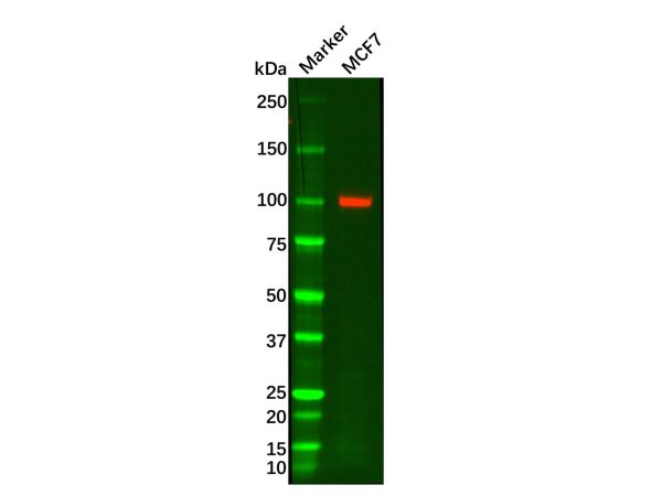 aladdin 阿拉丁 Ab088758 Recombinant Androgen Receptor Antibody Recombinant (RR632); Rabbit anti Human Androgen Receptor Antibody; WB, IHC; Unconjugated