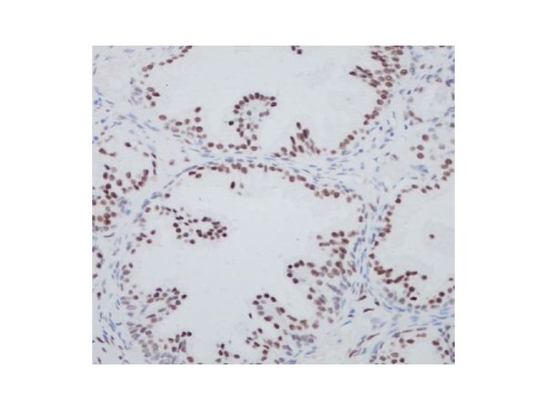 aladdin 阿拉丁 Ab088758 Recombinant Androgen Receptor Antibody Recombinant (RR632); Rabbit anti Human Androgen Receptor Antibody; WB, IHC; Unconjugated