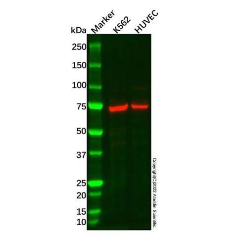 aladdin 阿拉丁 Ab088801 ANGPT2 Antibody pAb; Rabbit anti Human ANGPT2 Antibody; WB, IHC; Unconjugated