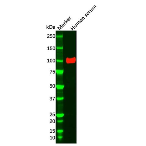 aladdin 阿拉丁 Ab088822 Angiostatin Mouse mAb mAb (C36); Mouse anti Human Angiostatin Antibody; WB, IHC; Unconjugated