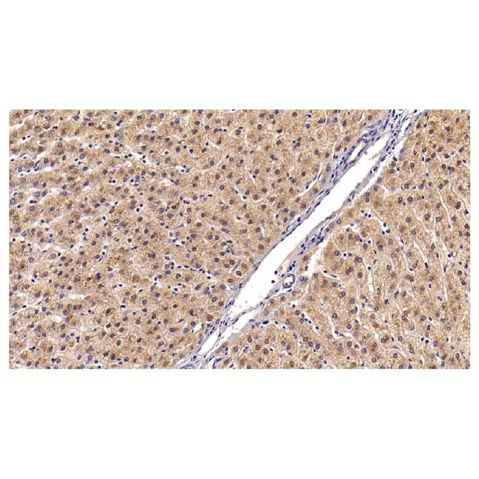 aladdin 阿拉丁 Ab088822 Angiostatin Mouse mAb mAb (C36); Mouse anti Human Angiostatin Antibody; WB, IHC; Unconjugated
