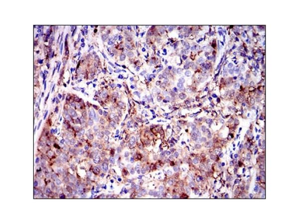 aladdin 阿拉丁 Ab088935 Annexin A1/ANXA1 Mouse mAb mAb (2F1); Mouse anti Human Annexin A1/ANXA1 Antibody; ELISA, WB, IHC; Unconjugated