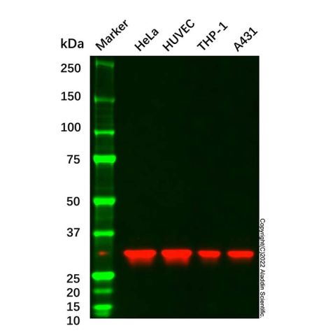 aladdin 阿拉丁 Ab088957 ANXA5 Mouse mAb mAb (C13); Mouse anti Human ANXA5 Antibody; WB, IHC, IF, ICC; Unconjugated