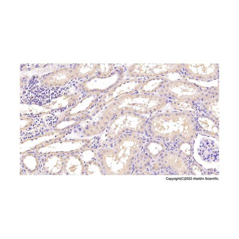 aladdin 阿拉丁 Ab088957 ANXA5 Mouse mAb mAb (C13); Mouse anti Human ANXA5 Antibody; WB, IHC, IF, ICC; Unconjugated