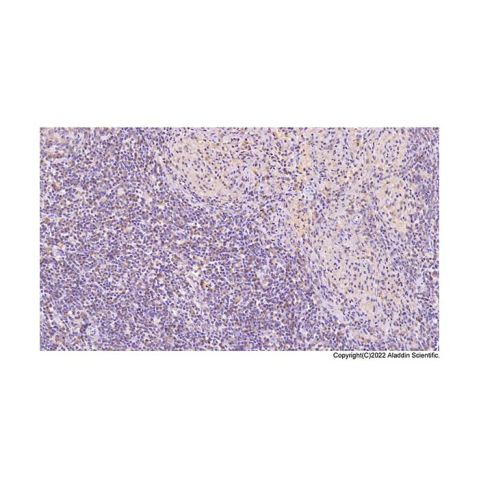 aladdin 阿拉丁 Ab088957 ANXA5 Mouse mAb mAb (C13); Mouse anti Human ANXA5 Antibody; WB, IHC, IF, ICC; Unconjugated