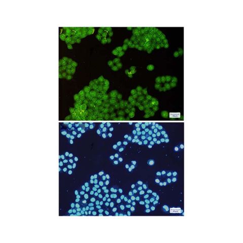 aladdin 阿拉丁 Ab089000 Recombinant Annexin-6/ANXA6 Antibody Recombinant (R03-6H4); Rabbit anti Human Annexin-6/ANXA6 Antibody; WB, IHC, ICC, IF; Unconjugated