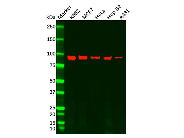 aladdin 阿拉丁 Ab089519 Recombinant Argonaute-2 Antibody Recombinant (R04-5H0); Rabbit anti Human Argonaute-2 Antibody; WB, ICC, IF; Unconjugated