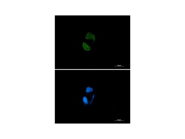 aladdin 阿拉丁 Ab089519 Recombinant Argonaute-2 Antibody Recombinant (R04-5H0); Rabbit anti Human Argonaute-2 Antibody; WB, ICC, IF; Unconjugated