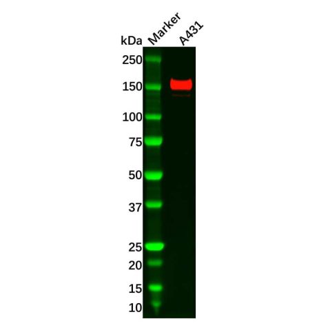 aladdin 阿拉丁 Ab089824 ASK1 Antibody pAb; Rabbit anti Human ASK1 Antibody; WB, IHC; Unconjugated