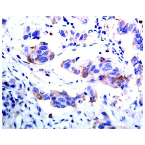 aladdin 阿拉丁 Ab089824 ASK1 Antibody pAb; Rabbit anti Human ASK1 Antibody; WB, IHC; Unconjugated