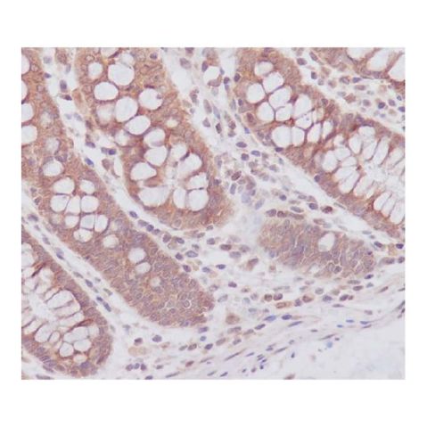 aladdin 阿拉丁 Ab090020 ATG7 Antibody pAb; Rabbit anti Human ATG7 Antibody; WB, IHC; Unconjugated