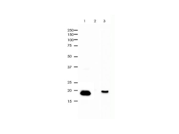 aladdin 阿拉丁 Ab090652 Recombinant Bax Antibody Recombinant (RR647); Rabbit anti Human Bax Antibody; WB, IHC, Flow, IP; Unconjugated