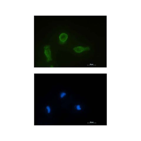 aladdin 阿拉丁 Ab090843 Recombinant Bcl-XL Antibody Recombinant (R02-2D3); Rabbit anti Human Bcl-XL Antibody; WB, IHC, IF, ICC; Unconjugated