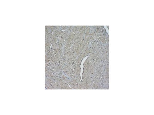 aladdin 阿拉丁 Ab091004 beta Actin Antibody pAb; Rabbit anti Human beta Actin Antibody; WB, Flow, IHC, IF, ICC; Unconjugated