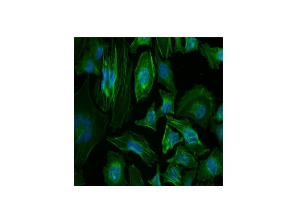 aladdin 阿拉丁 Ab091004 beta Actin Antibody pAb; Rabbit anti Human beta Actin Antibody; WB, Flow, IHC, IF, ICC; Unconjugated