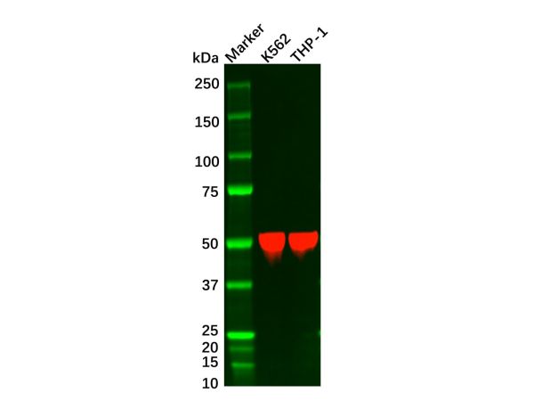 aladdin 阿拉丁 Ab091046 Recombinant ARRB1 Antibody Recombinant (R08-5I9); Rabbit anti Human ARRB1 Antibody; WB, IHC; Unconjugated