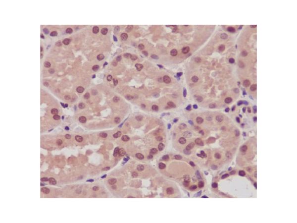 aladdin 阿拉丁 Ab091046 Recombinant ARRB1 Antibody Recombinant (R08-5I9); Rabbit anti Human ARRB1 Antibody; WB, IHC; Unconjugated