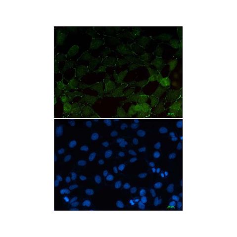 aladdin 阿拉丁 Ab091079 Recombinant beta Catenin Antibody Recombinant (R07-9D5); Rabbit anti Human beta Catenin Antibody; WB, ICC, IF; Unconjugated