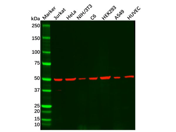 aladdin 阿拉丁 Ab091154 Recombinant beta III Tubulin Antibody Recombinant (RR607); Rabbit anti Human Beta III Tubulin Antibody; WB, Flow; Unconjugated