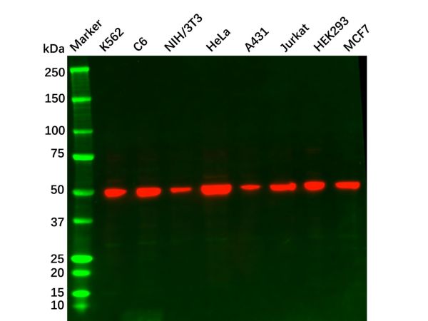 aladdin 阿拉丁 Ab091197 Recombinant beta Tubulin Antibody Recombinant (R09-3F4); Rabbit anti Human Beta Tubulin Antibody; WB, IHC, ICC, IF; Unconjugated