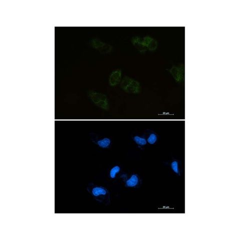 aladdin 阿拉丁 Ab091424 Recombinant BMP4 Antibody Recombinant (R01-2G4); Rabbit anti Human BMP4 Antibody; WB, ICC, IF; Unconjugated