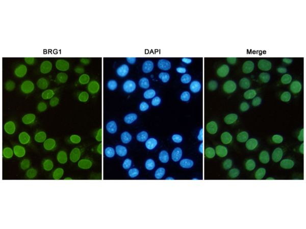 aladdin 阿拉丁 Ab091716 BRG1 Mouse mAb mAb (6D7-F7-B6); Mouse anti Human BRG1 Antibody; WB, ICC, IF, IP; Unconjugated