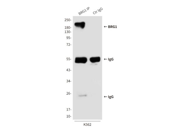 aladdin 阿拉丁 Ab091716 BRG1 Mouse mAb mAb (6D7-F7-B6); Mouse anti Human BRG1 Antibody; WB, ICC, IF, IP; Unconjugated