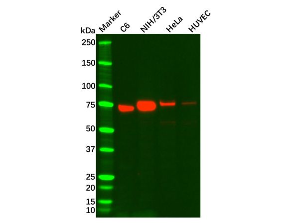 aladdin 阿拉丁 Ab092465 Recombinant Caldesmon/CDM Antibody Recombinant (R05-3D2); Rabbit anti Human Caldesmon/CDM Antibody; WB, IHC; Unconjugated