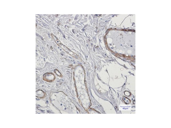 aladdin 阿拉丁 Ab092465 Recombinant Caldesmon/CDM Antibody Recombinant (R05-3D2); Rabbit anti Human Caldesmon/CDM Antibody; WB, IHC; Unconjugated