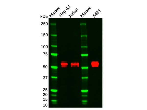 aladdin 阿拉丁 Ab092652 CaMKII Mouse mAb mAb (8G10C1); Mouse anti Human/Rat CaMKII Antibody; WB, IHC, Flow, ELISA; Unconjugated