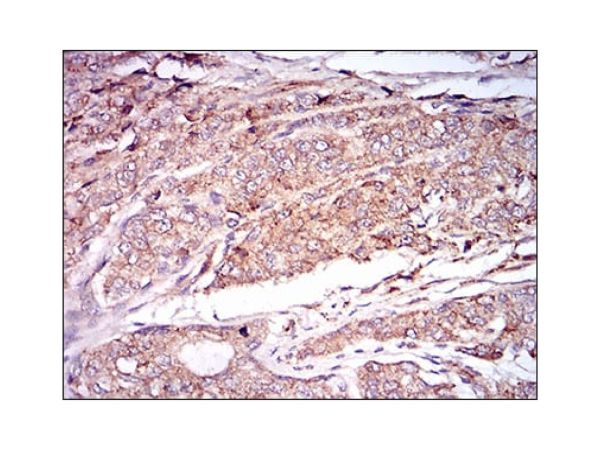 aladdin 阿拉丁 Ab092652 CaMKII Mouse mAb mAb (8G10C1); Mouse anti Human/Rat CaMKII Antibody; WB, IHC, Flow, ELISA; Unconjugated