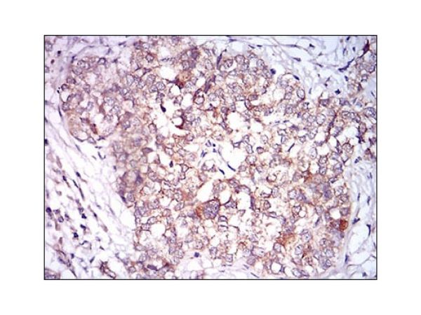 aladdin 阿拉丁 Ab092652 CaMKII Mouse mAb mAb (8G10C1); Mouse anti Human/Rat CaMKII Antibody; WB, IHC, Flow, ELISA; Unconjugated