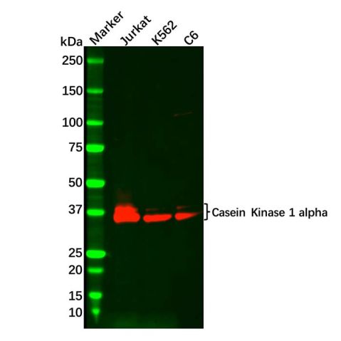 aladdin 阿拉丁 Ab092949 Recombinant Casein Kinase 1 alpha Antibody Recombinant (R05-6C6); Rabbit anti Human Casein Kinase 1 alpha Antibody; WB; Unconjugated