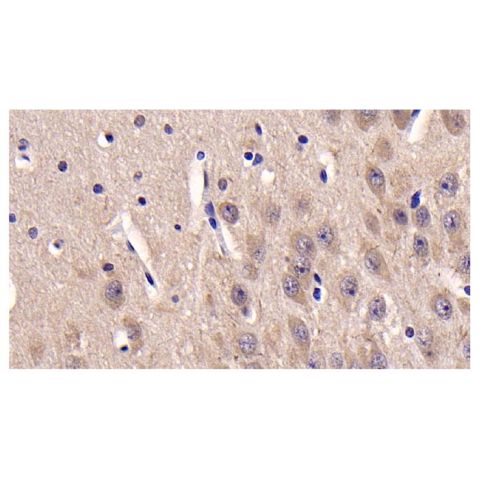 aladdin 阿拉丁 Ab092954 Casein Kinase 1 delta/CSNK1D Mouse mAb mAb(C3); Mouse anti Human Casein Kinase 1 delta/CSNK1D Antibody; WB, IHC; Unconjugated