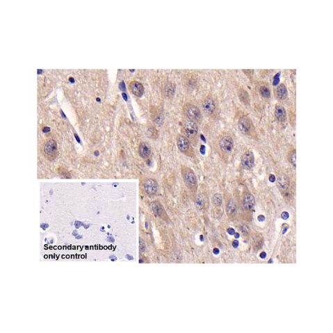 aladdin 阿拉丁 Ab092954 Casein Kinase 1 delta/CSNK1D Mouse mAb mAb(C3); Mouse anti Human Casein Kinase 1 delta/CSNK1D Antibody; WB, IHC; Unconjugated