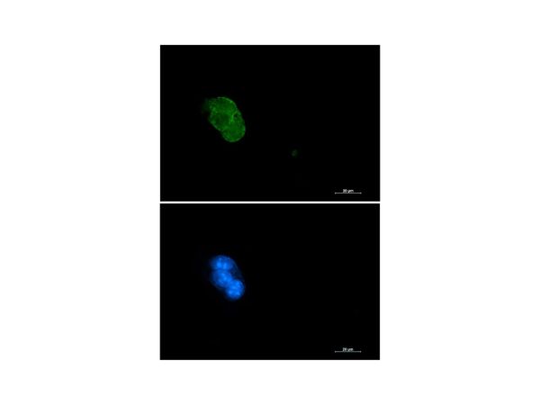 aladdin 阿拉丁 Ab093013 Recombinant Caspase3 Antibody Recombinant (R02-7C2); Rabbit anti Human Caspase3 Antibody; WB, IHC, ICC, IF; Unconjugated