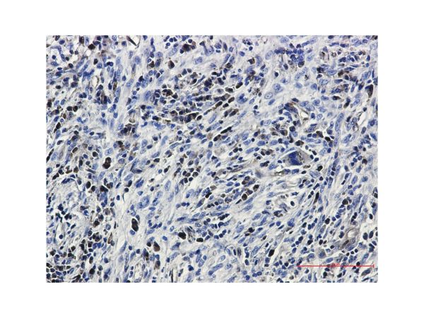 aladdin 阿拉丁 Ab093013 Recombinant Caspase3 Antibody Recombinant (R02-7C2); Rabbit anti Human Caspase3 Antibody; WB, IHC, ICC, IF; Unconjugated