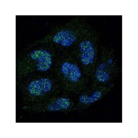 aladdin 阿拉丁 Ab093061 Recombinant Caspase-8 Antibody Recombinant (R06-3K2); Rabbit anti Human Caspase-8 Antibody; WB, IHC, ICC, IF; Unconjugated