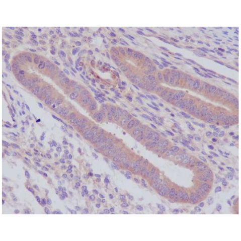 aladdin 阿拉丁 Ab093061 Recombinant Caspase-8 Antibody Recombinant (R06-3K2); Rabbit anti Human Caspase-8 Antibody; WB, IHC, ICC, IF; Unconjugated