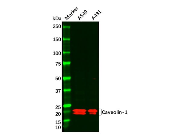 aladdin 阿拉丁 Ab093242 Caveolin-1 Antibody pAb; Rabbit anti Human Caveolin-1 Antibody; WB, IHC; Unconjugated