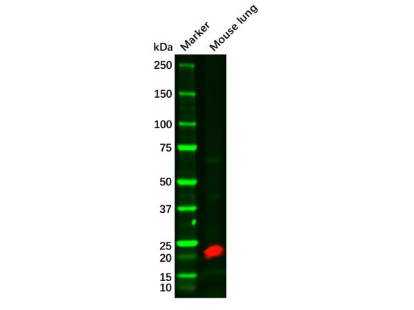 aladdin 阿拉丁 Ab093242 Caveolin-1 Antibody pAb; Rabbit anti Human Caveolin-1 Antibody; WB, IHC; Unconjugated