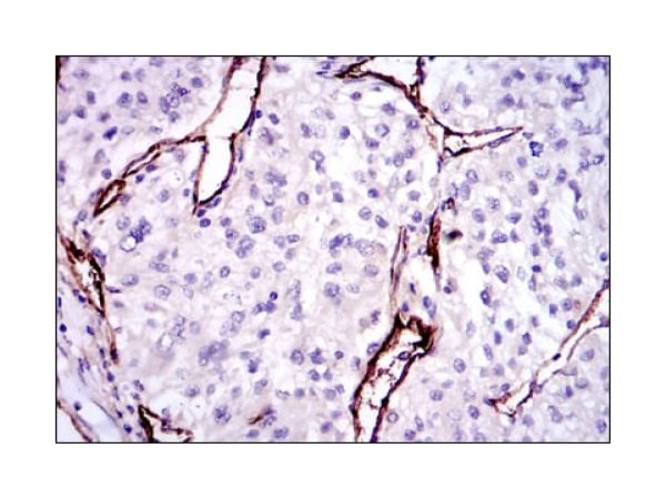 aladdin 阿拉丁 Ab093671 CD105 Mouse mAb mAb (3A9); Mouse anti Human CD105 Antibody; WB, IHC, Flow, ELISA, ICC, IF; Unconjugated