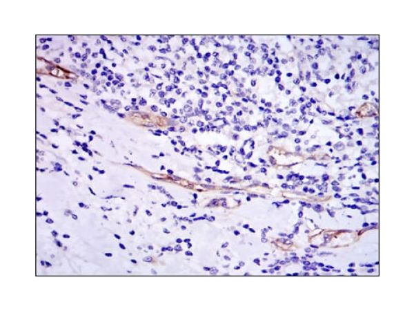 aladdin 阿拉丁 Ab093671 CD105 Mouse mAb mAb (3A9); Mouse anti Human CD105 Antibody; WB, IHC, Flow, ELISA, ICC, IF; Unconjugated