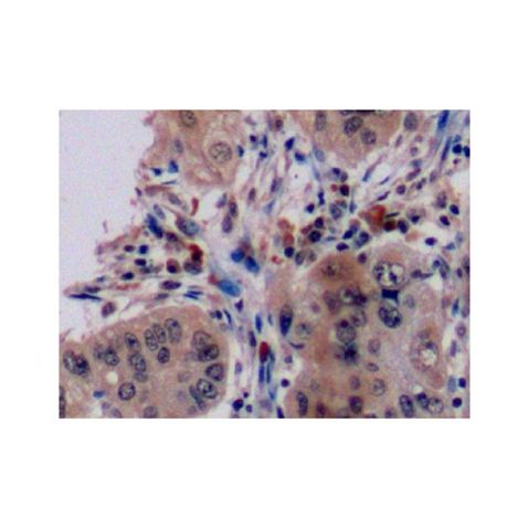 aladdin 阿拉丁 Ab095317 CD79a Antibody pAb; Rabbit anti Human CD79a Antibody; WB, IHC, Flow; Unconjugated