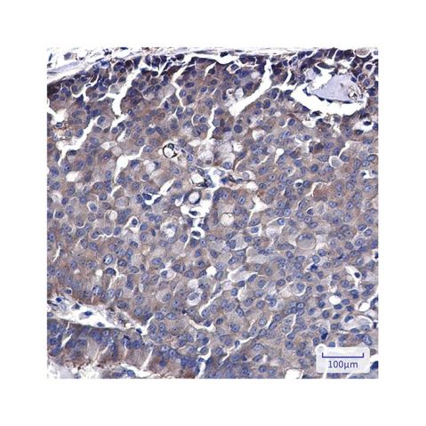 aladdin 阿拉丁 Ab095626 Recombinant Cdc37 Antibody Recombinant (R06-8F1); Rabbit anti Human Cdc37 Antibody; WB, IHC Unconjugated